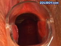 Raunchy brownhead bitch gets her vagina stretched wide as hell with speculum. Deep vaginal cave is exposed in close-up shot. Later in wicked porn clip, brunette babe sucking cock craving for happy ending. She is glad to get her mouth filled with fat mouth cumshot.