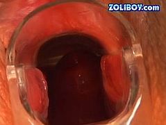 Raunchy brownhead bitch gets her vagina stretched wide as hell with speculum. Deep vaginal cave is exposed in close-up shot. Later in wicked porn clip, brunette babe sucking cock craving for happy ending. She is glad to get her mouth filled with fat mouth cumshot.