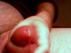 fat pumped foreskin