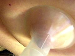 Breastpump Induced Lactation