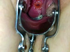 Speculum plus masturbation