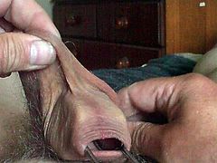 Foreskin and scrotum - 30 minute video